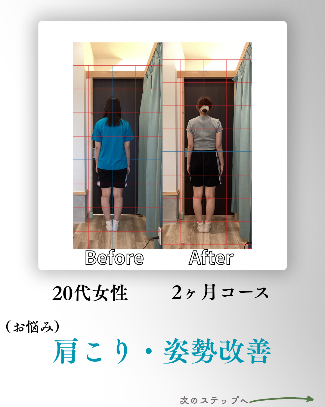 肩こり・姿勢BA1