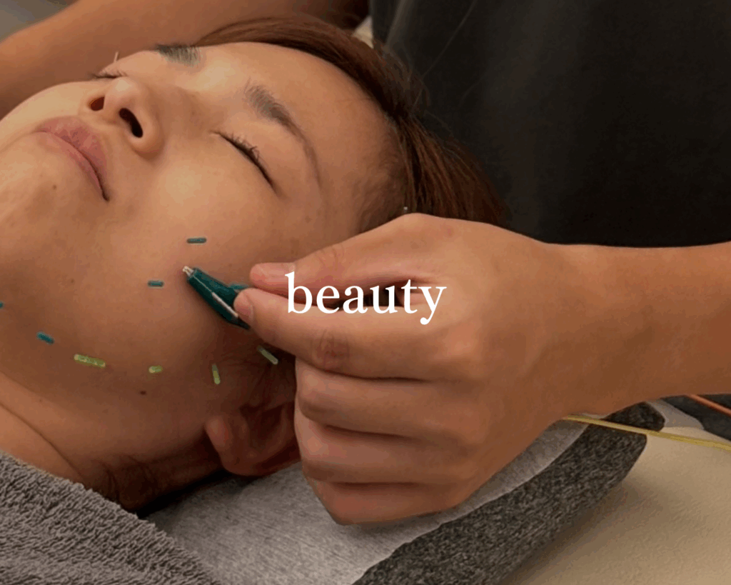 美容鍼をしている写真